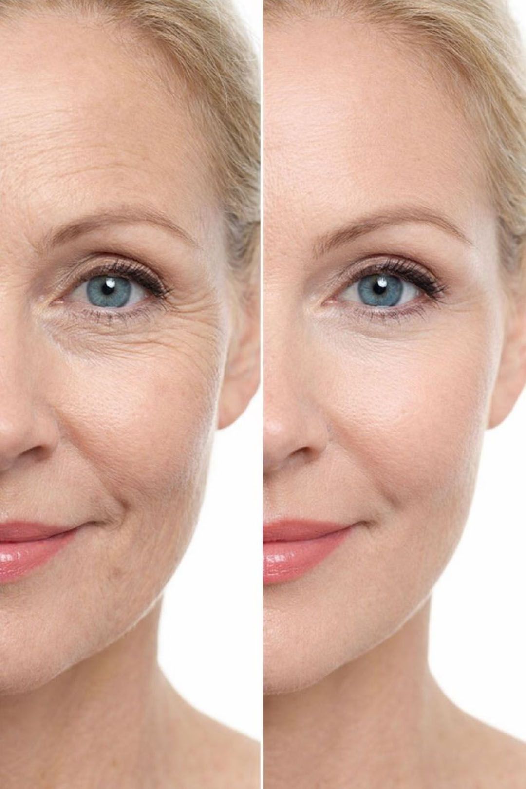 Nikki Temple LED Face Mask ClearSkin Glow II Mask for Wrinkles and Fine Lines, Pink