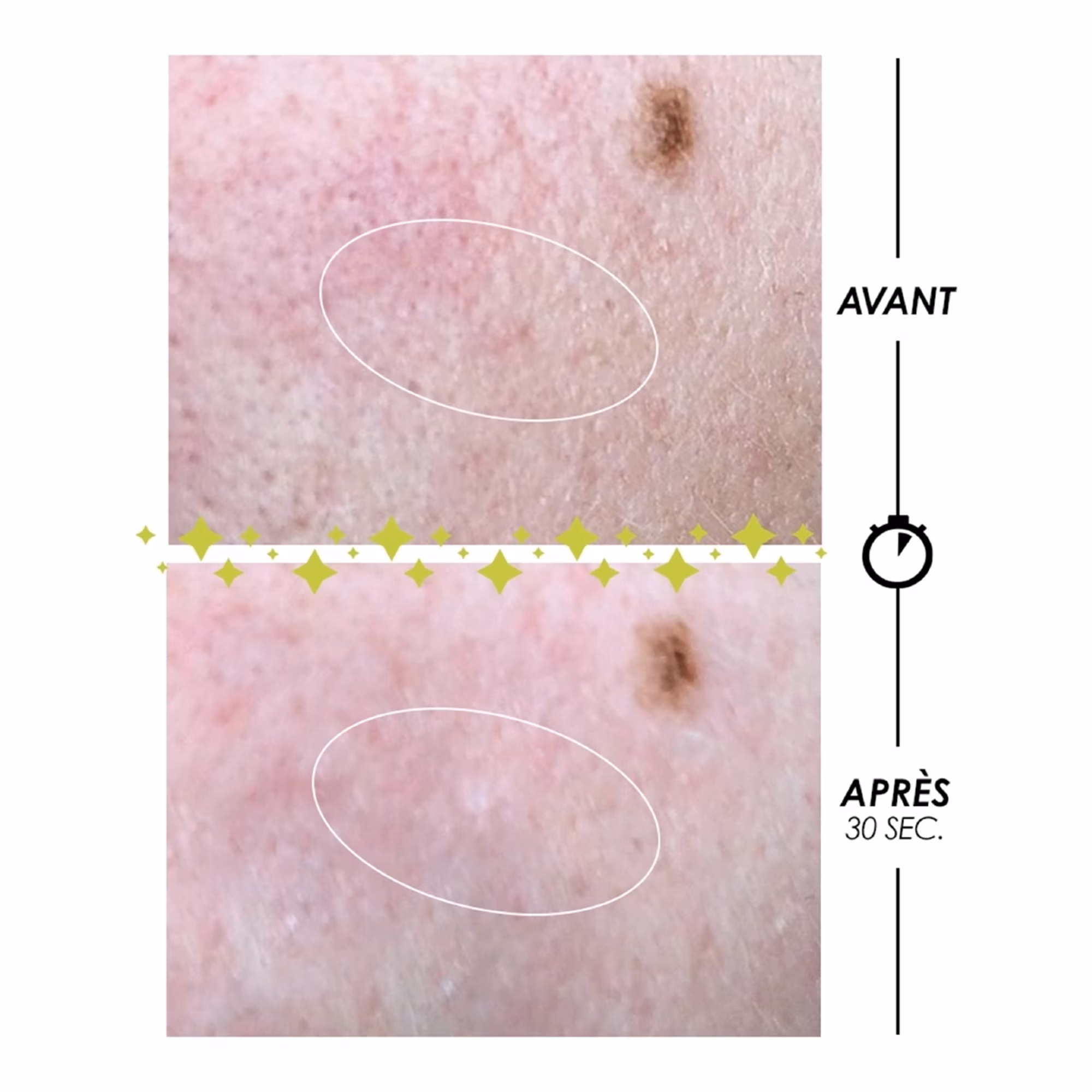 PSCHITT MAGIQUEMicropeeling sans grain à action biologique