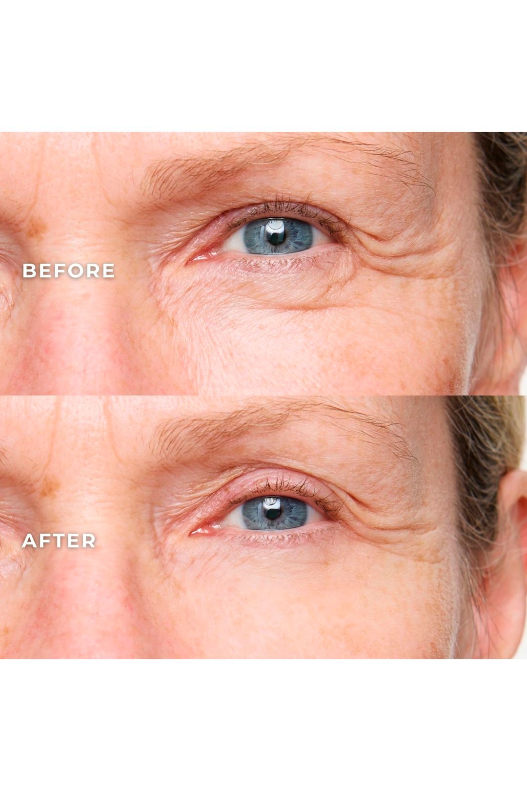 WUNDERBROW Wunderlift 60 Second Wrinkle Reducer