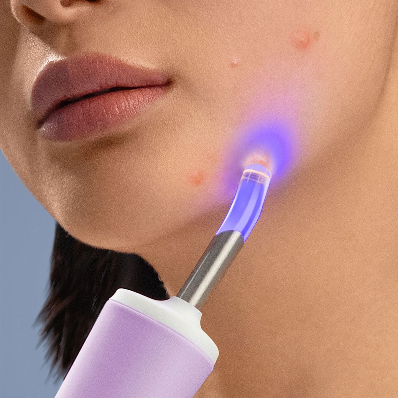 FOREO ESPADA 2 Plus Lavender