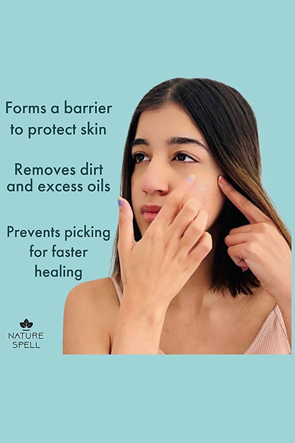 Nature Spell Clear My Spots Pimple Patches - 36 Translucent Hydrocolloid Patches