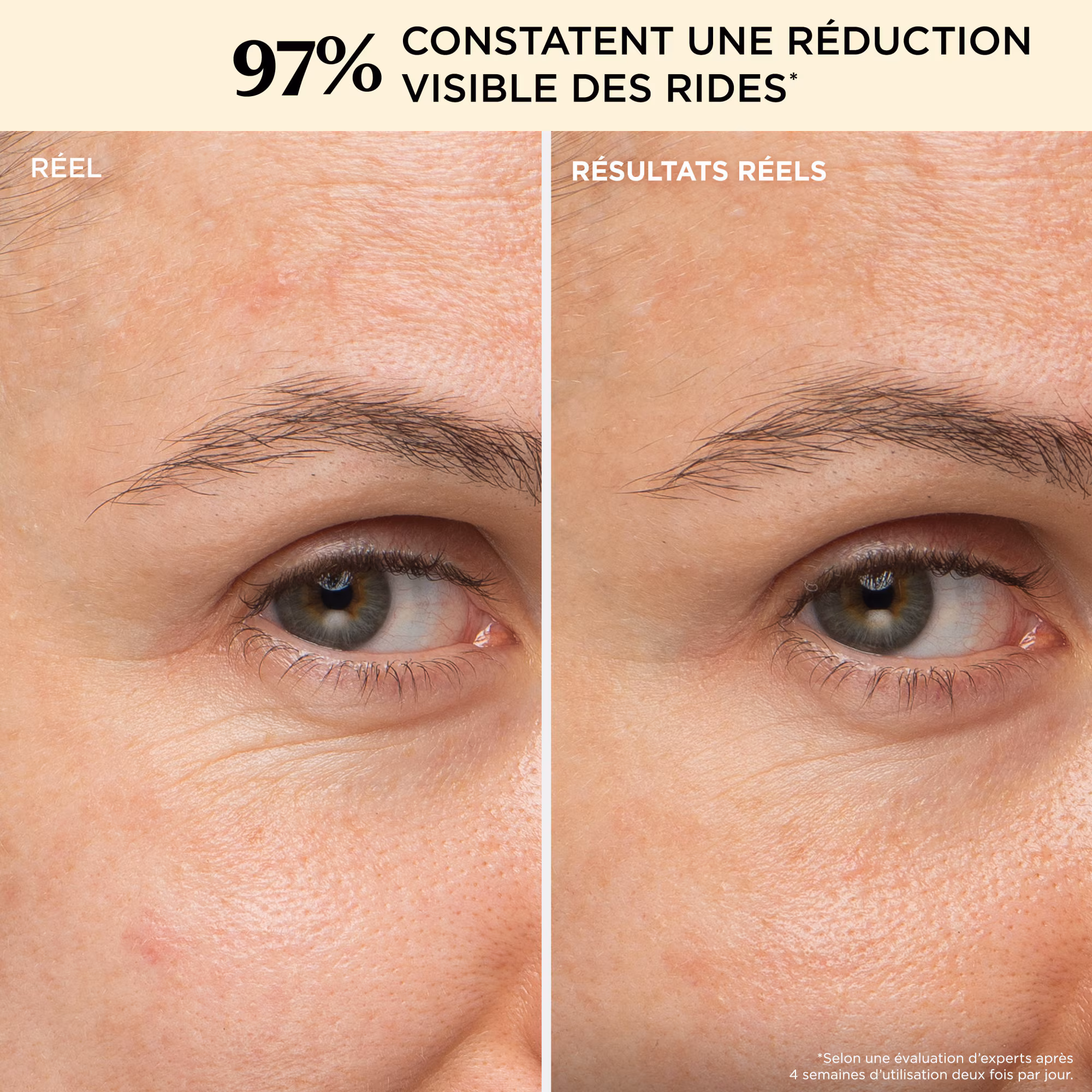 CONFIDENCE IN CREAM? SUPERCHARGEDCrème hydratante anti-âge