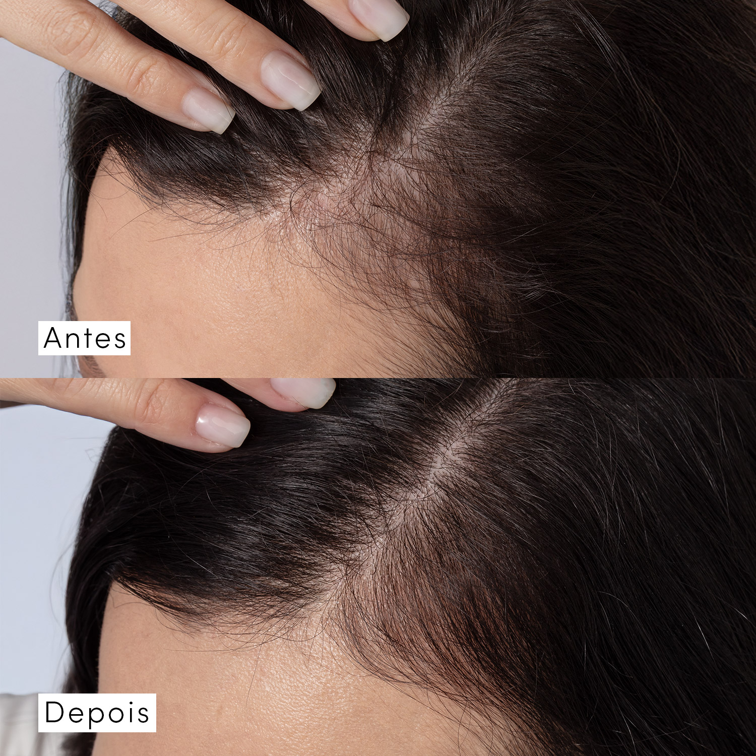 Máscara Capilar Siàge Dermo Hair Resistência Antiqueda 250g