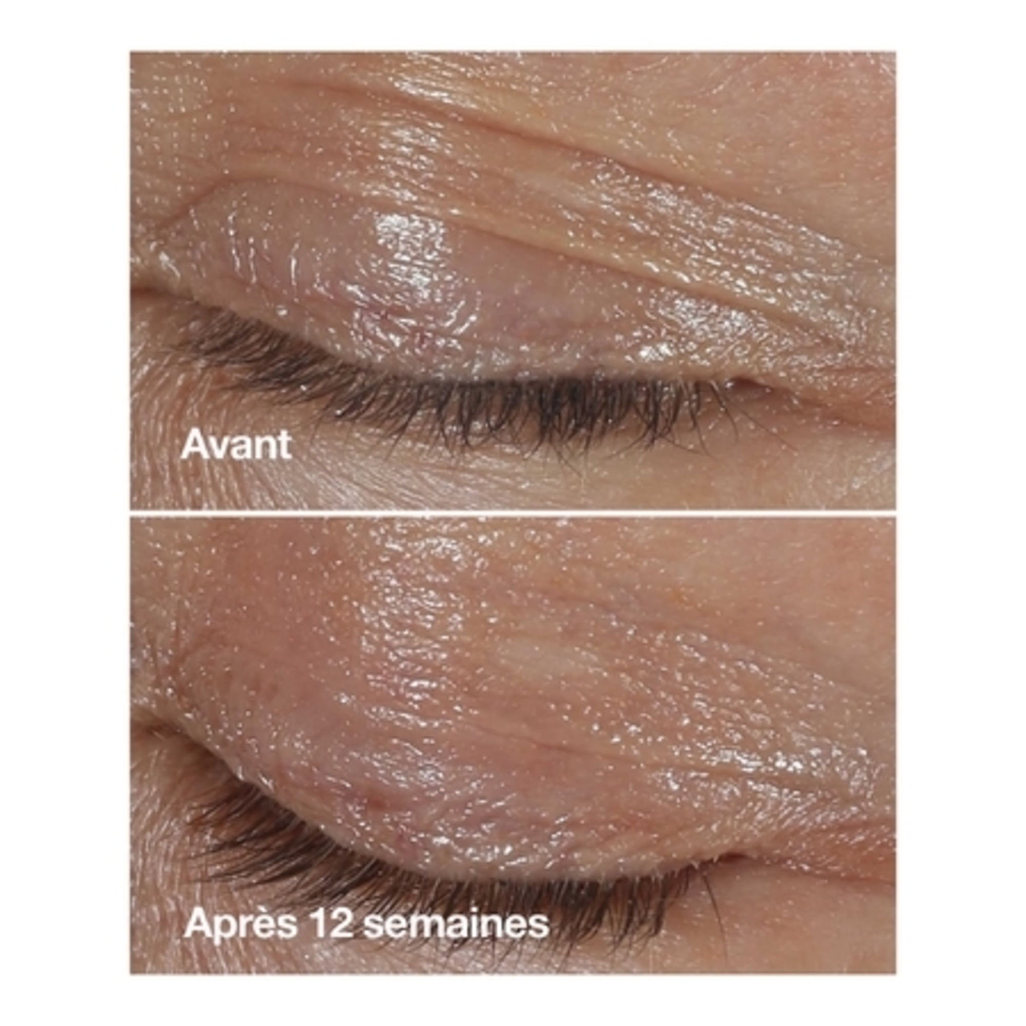 SMART CLINICAL REPAIRCrème Yeux Correction Rides