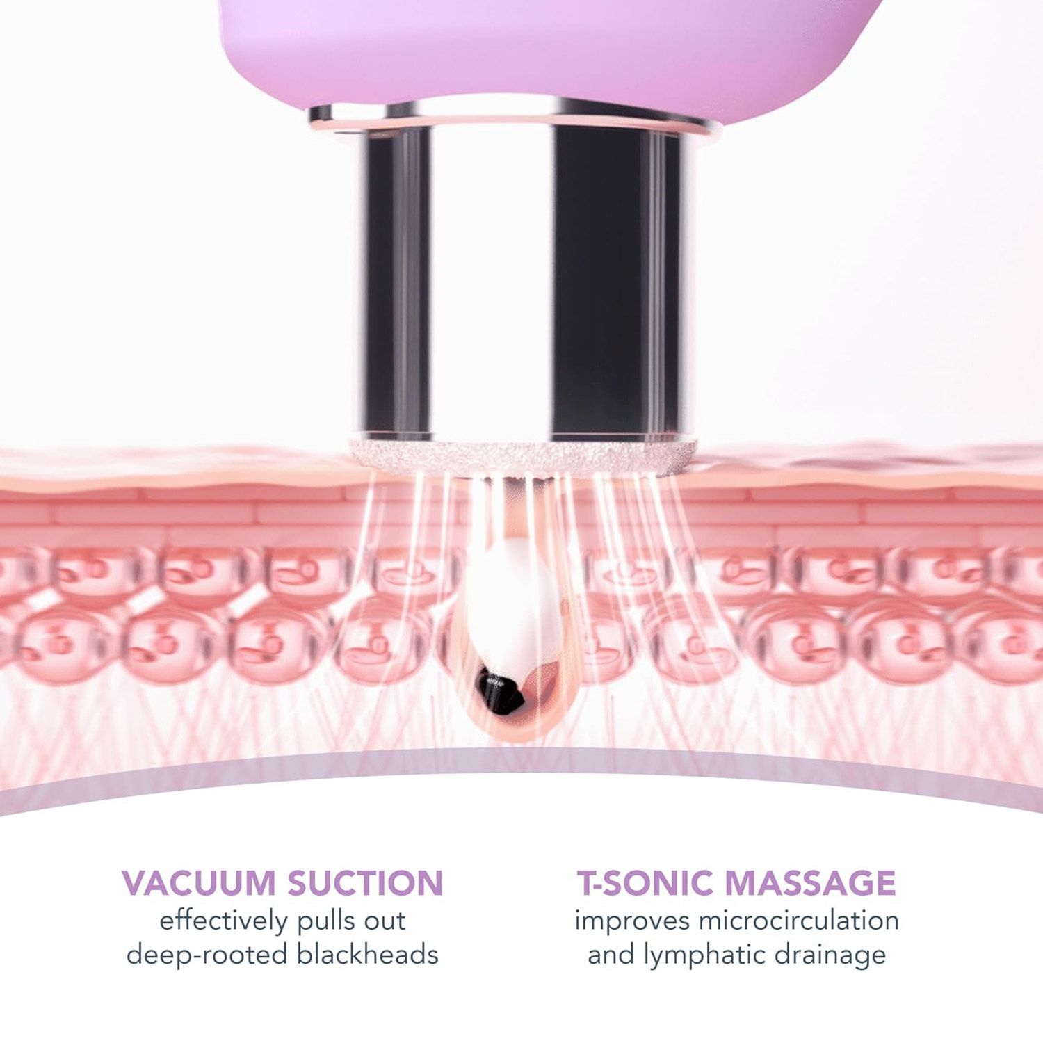 FOREO KIWI DERMA