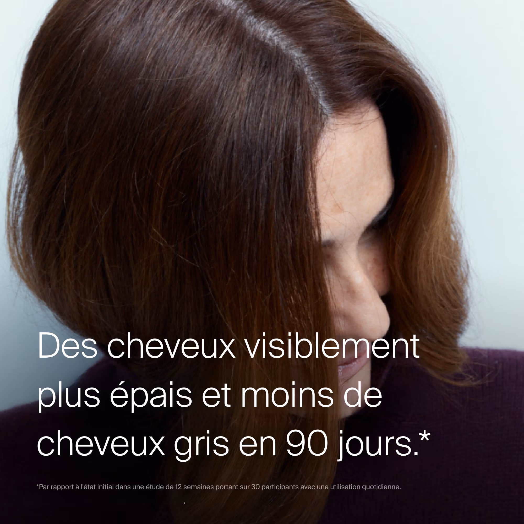 SCALP CARESérum - traitement cuir chevelu