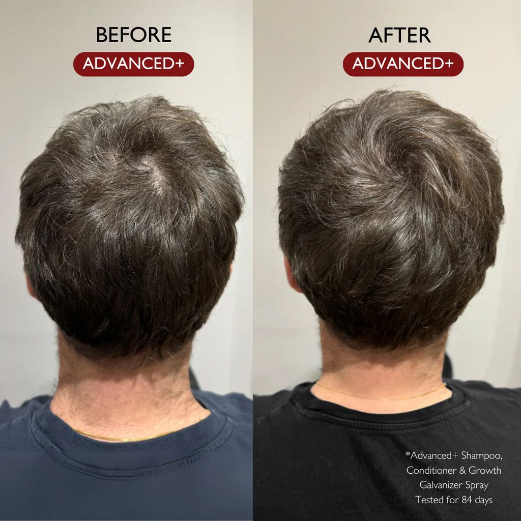 Daimon Barber Hair Growth Galvanizer