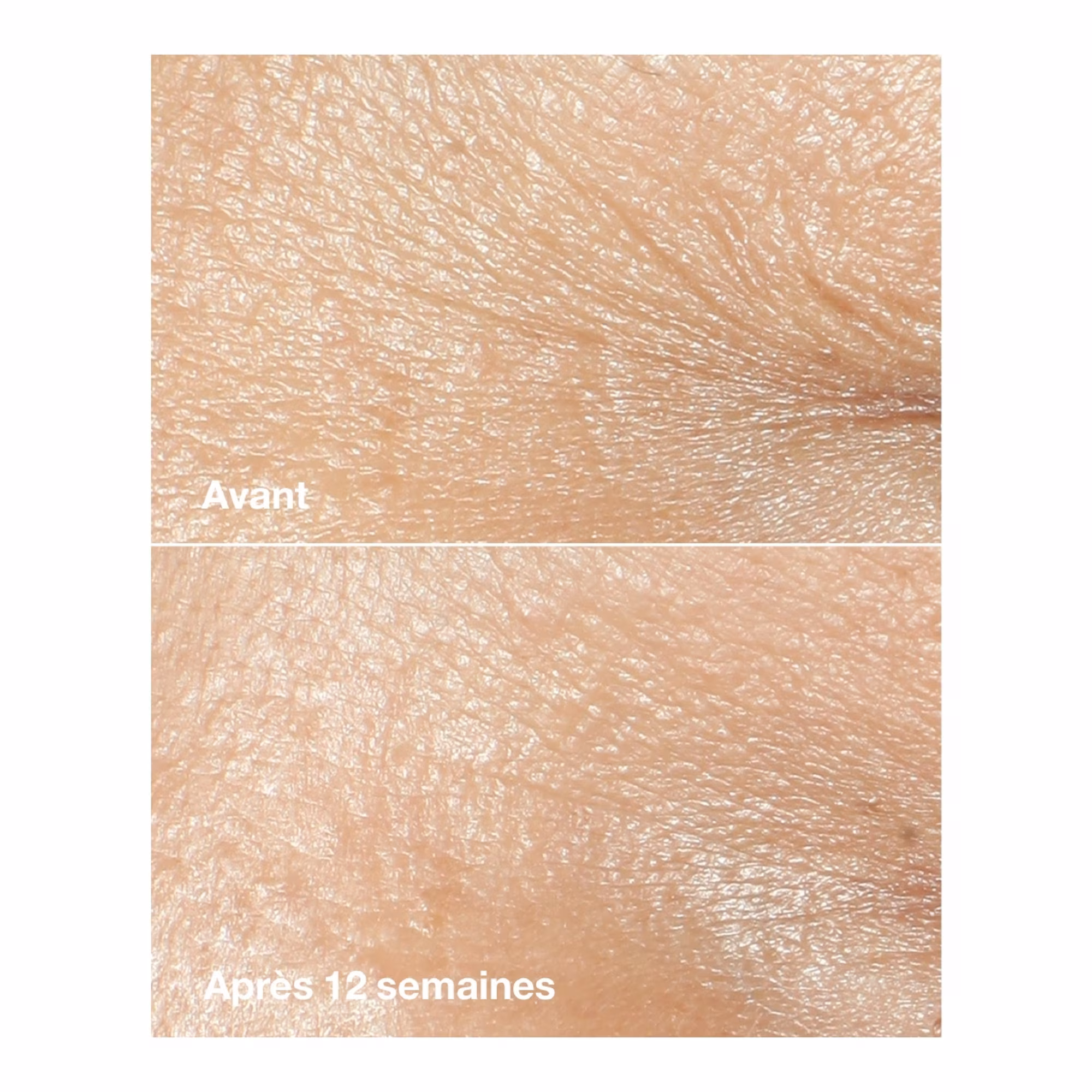 CLINIQUE SMARTSmart clinical repair? - crème correctrice anti-rides