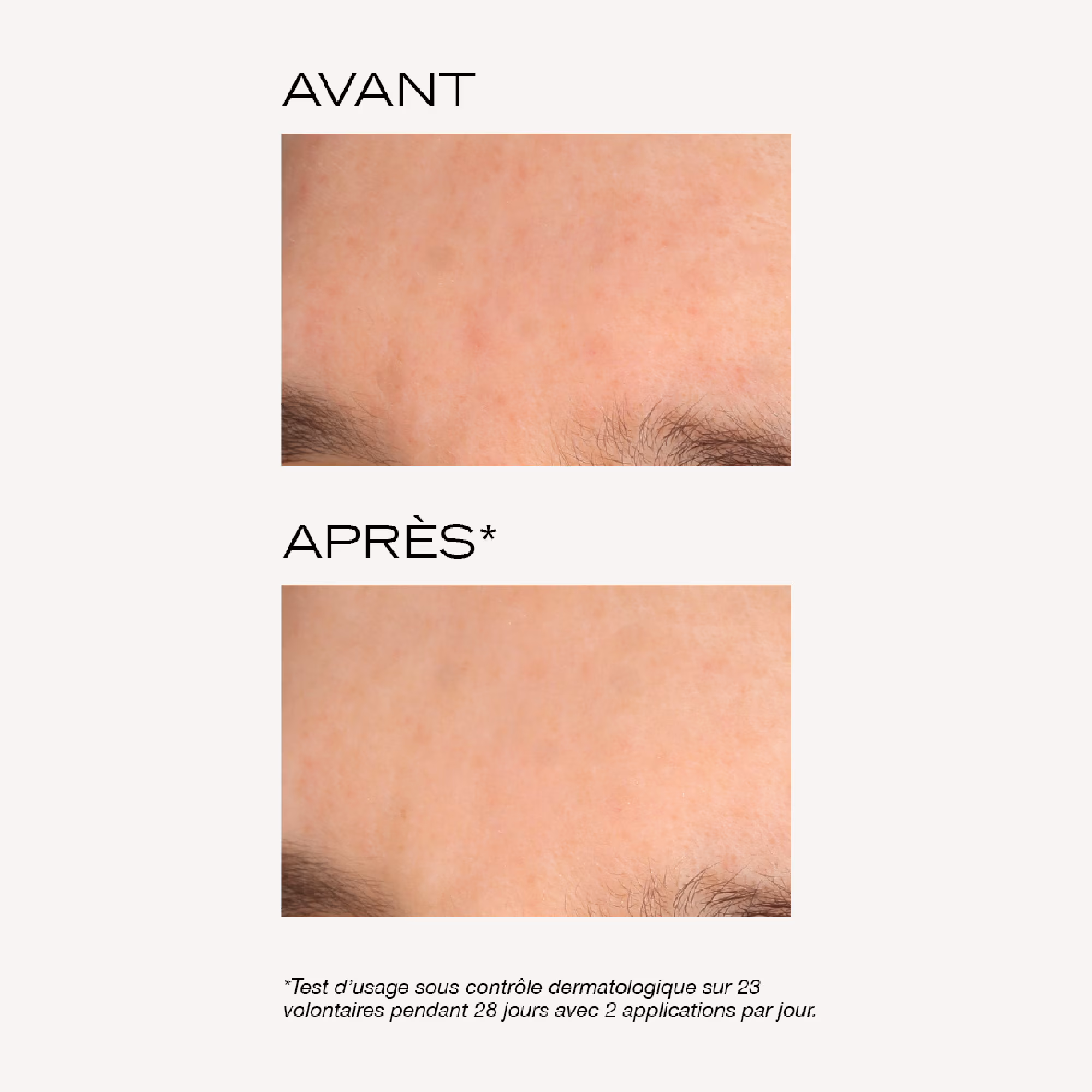 NUEMasque peeling intense