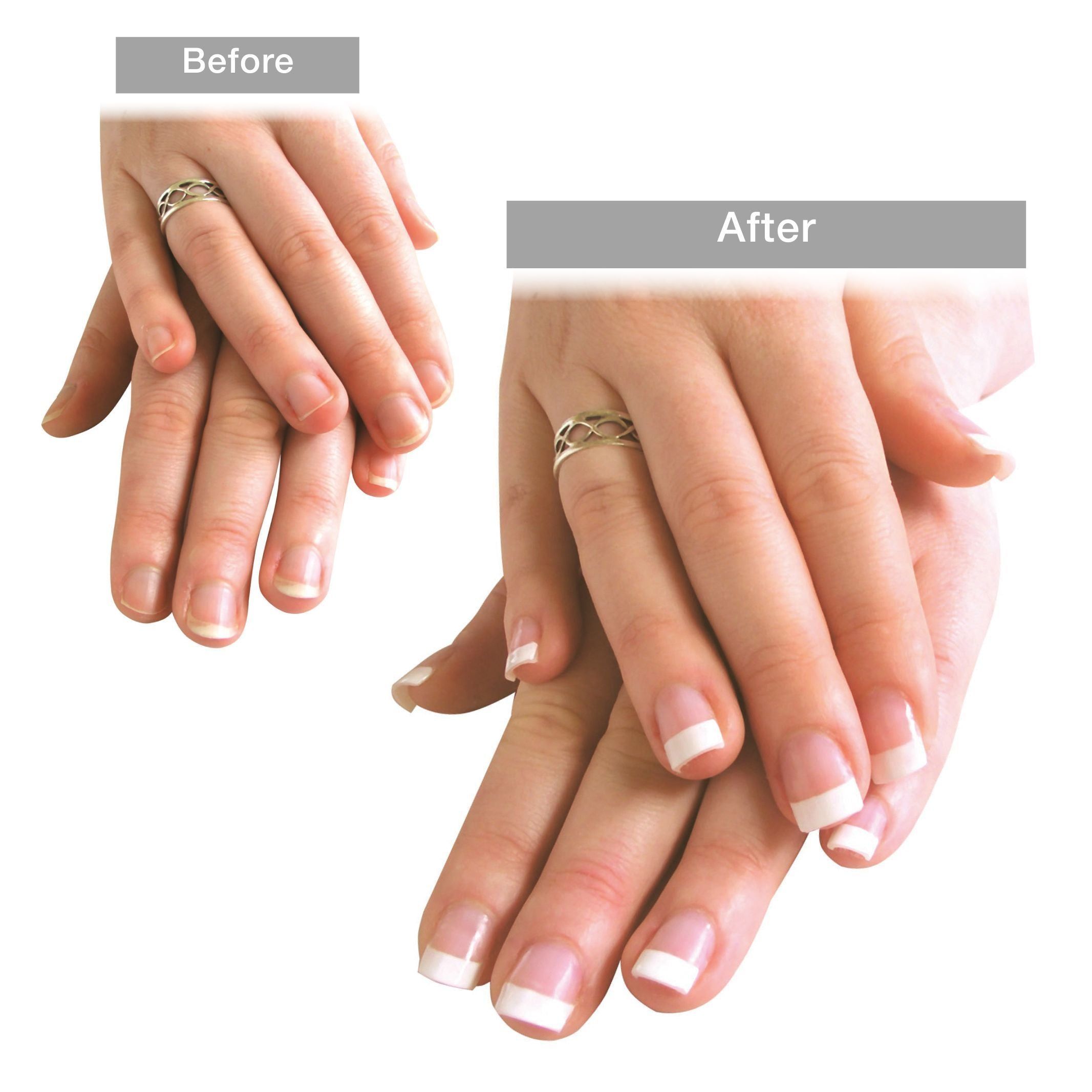 Rio UV Gel Nail Extension Kit