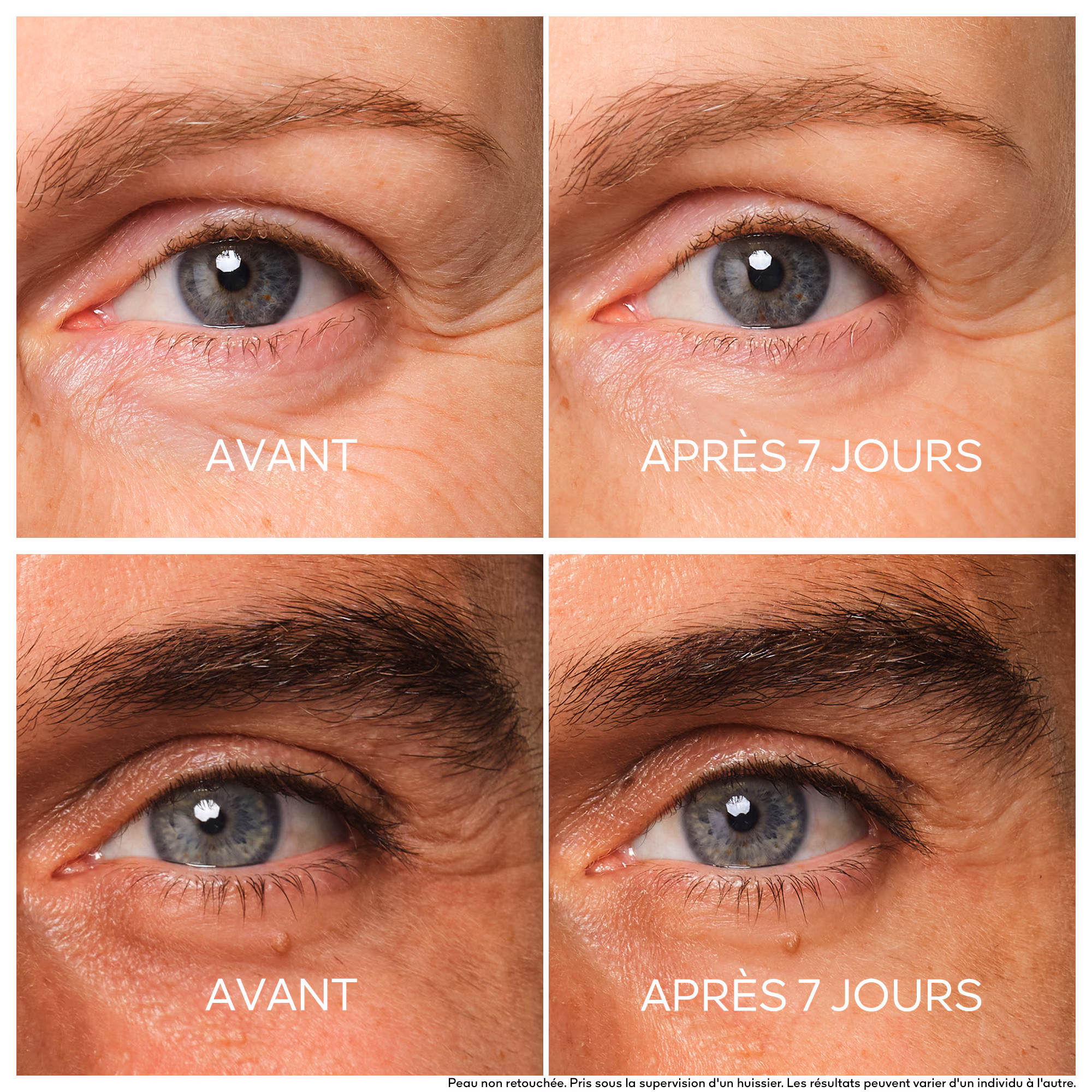 ABEILLE ROYALESoin yeux réparateur jeunesse
