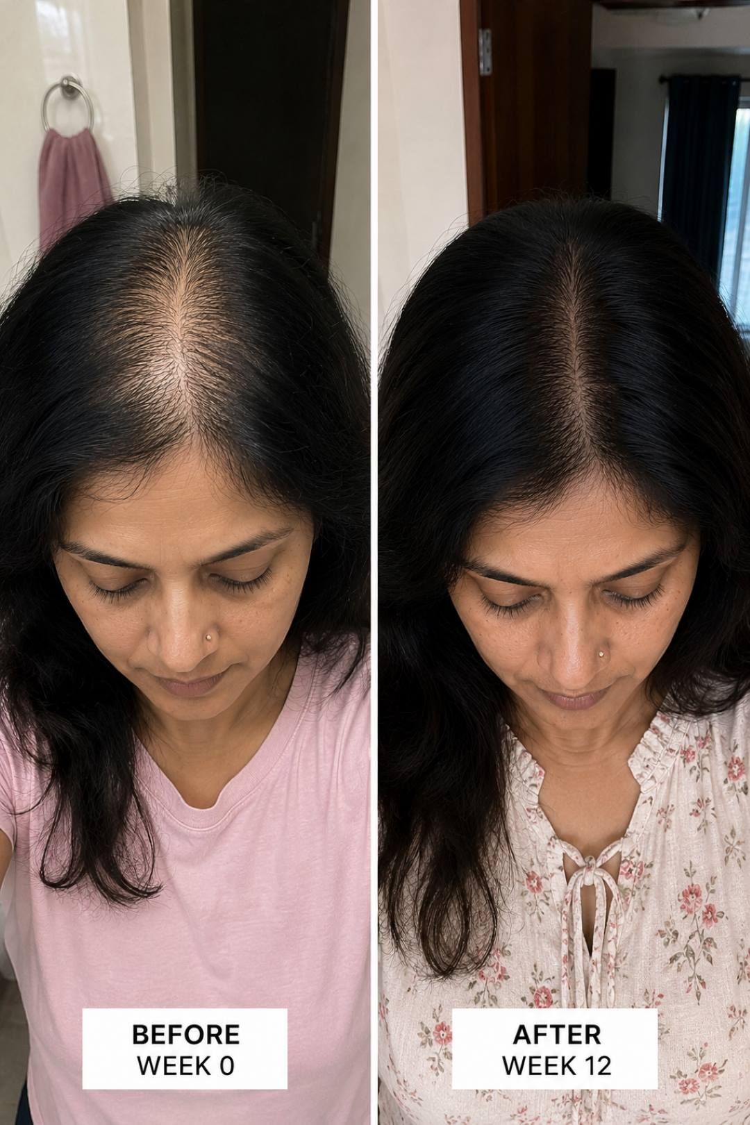 Nikki Temple Hair Loss Prevention Red Light Therapy Cap for Hair Loss Treatment