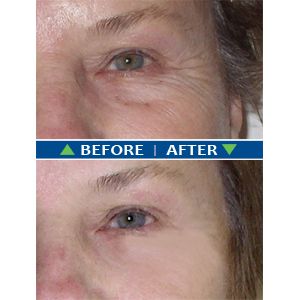 BodyVerde Overnight Miracle Cream