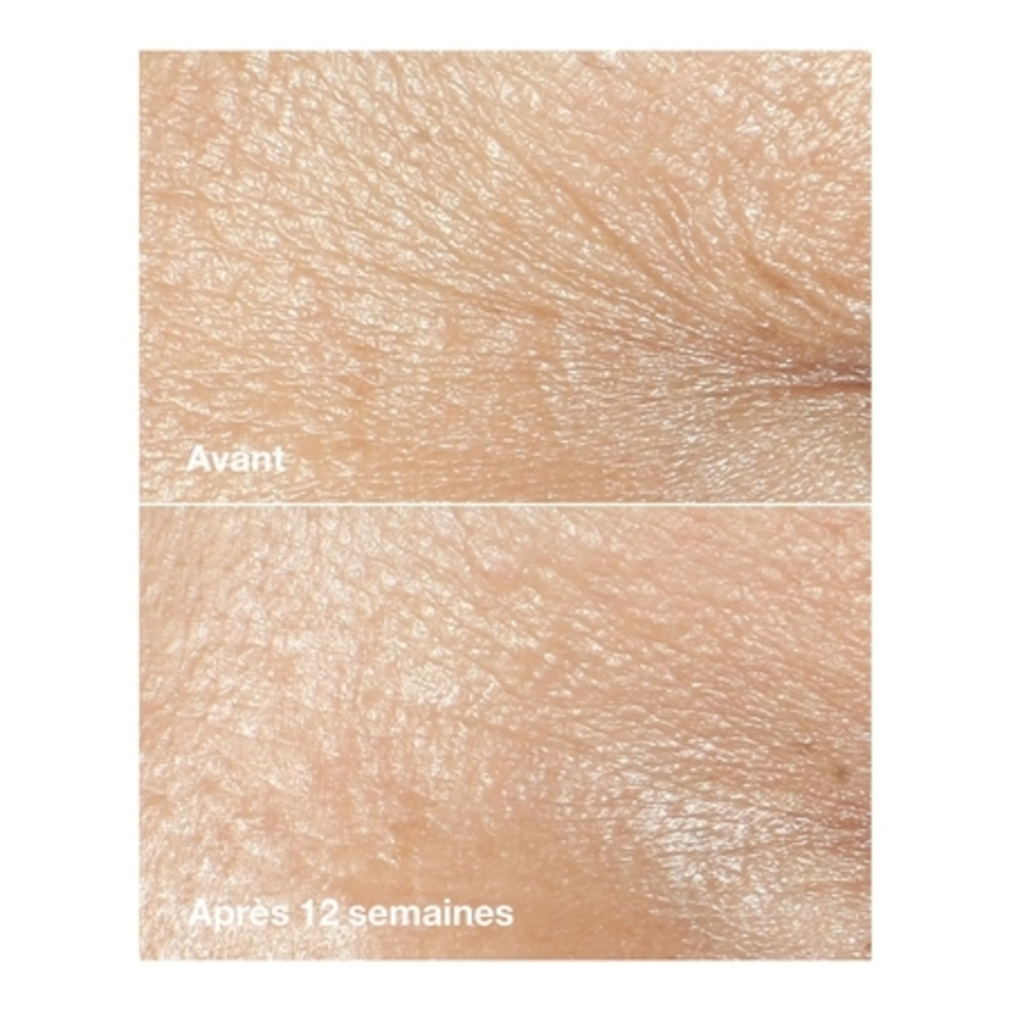 CLINIQUE SMARTSmart clinical repair™ - crème riche correctrice anti-rides
