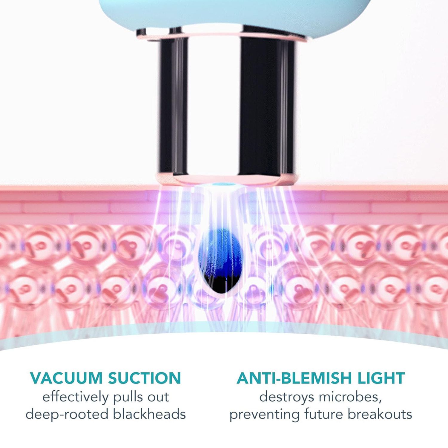 FOREO KIWI