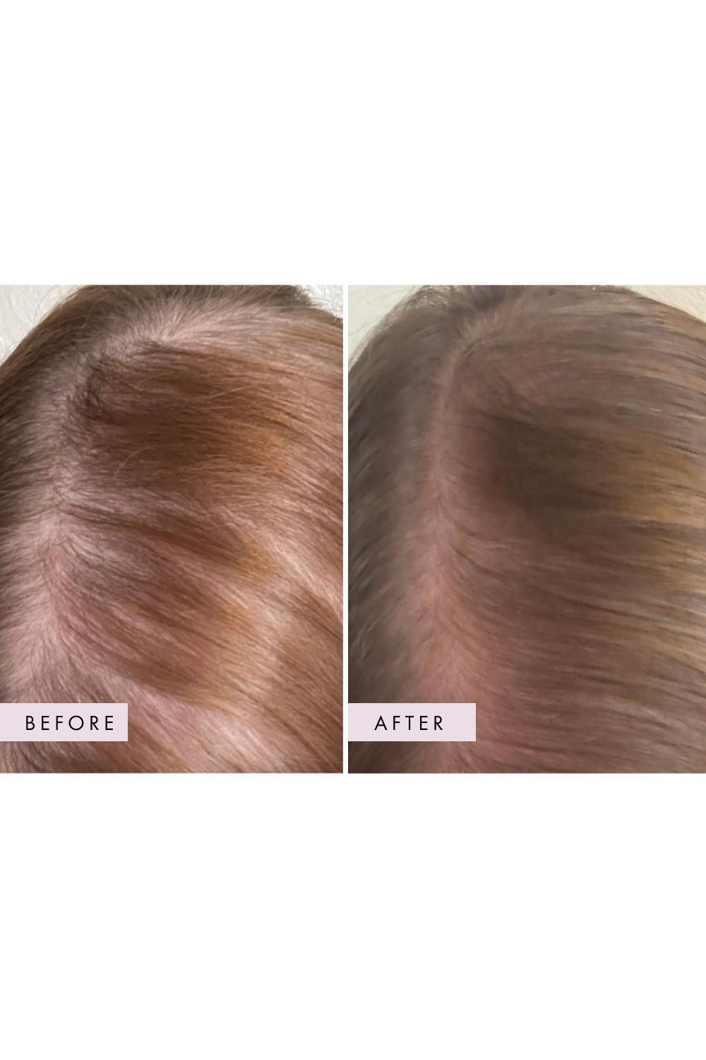 Hair Gain Scalp Foam 50ml