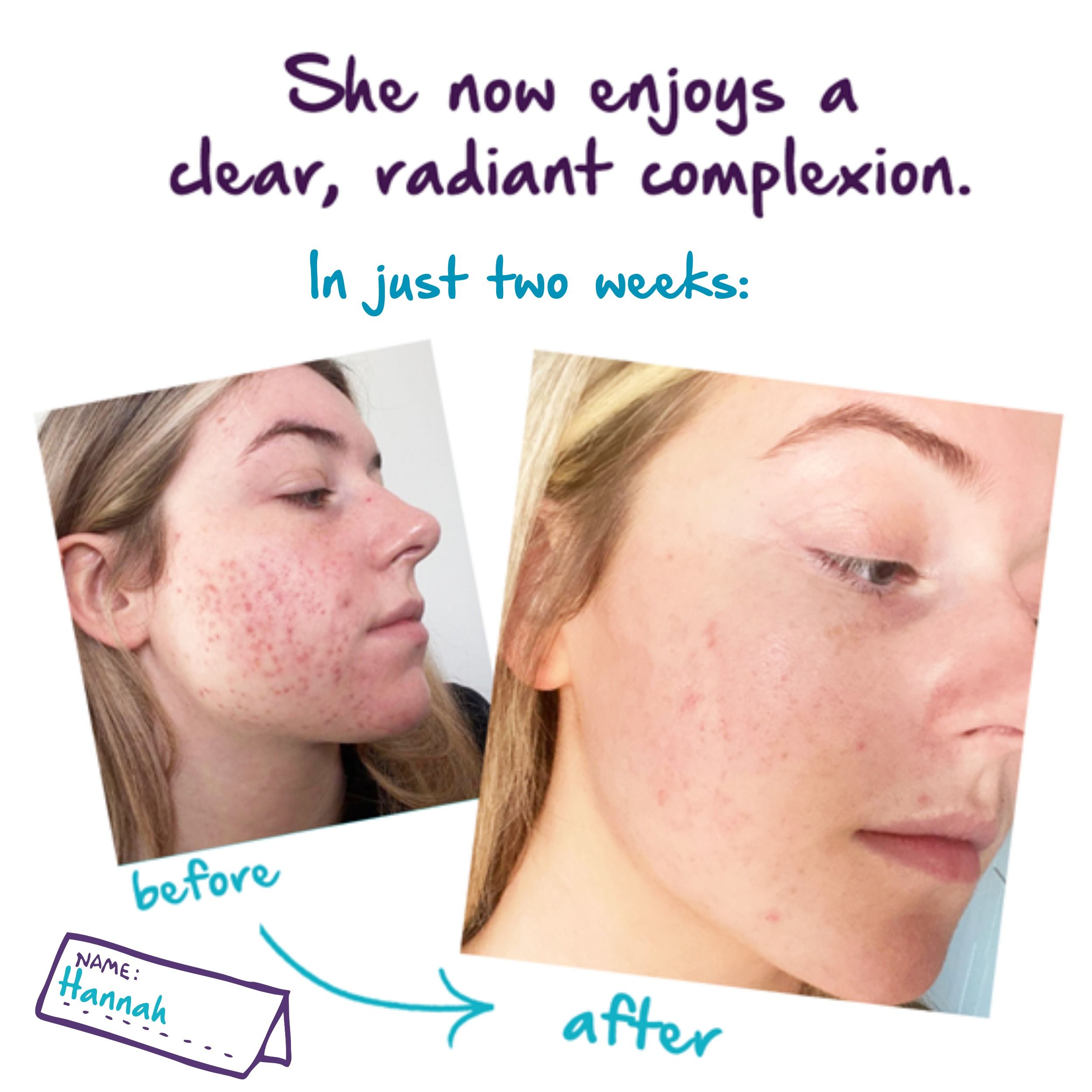 Bare Addiction Skincare Bare necessity Three Care Set