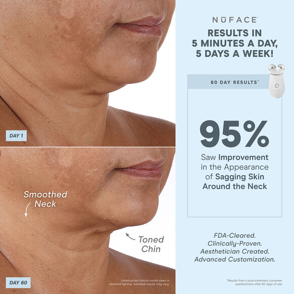 Nuface<br>Trinity+® Wrinkle Reducer Attachment
