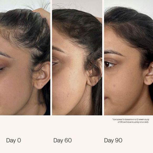 Living Proof<br>Scalp Care Density Serum