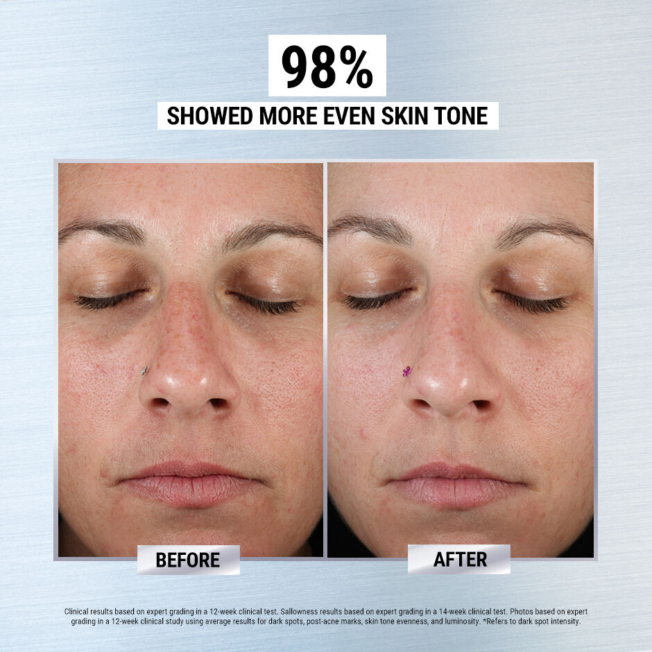 Clearly Corrective Dark Spot Corrector