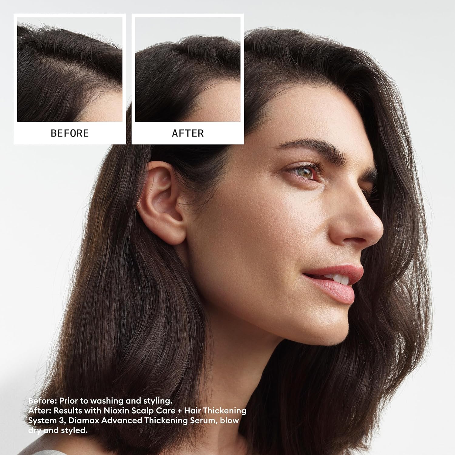 Nioxin Scalp + Hair Thickening System 2 - Hair Thickening System for Natural Hair with Progressed Thinning, Full Size (Packaging May Vary)