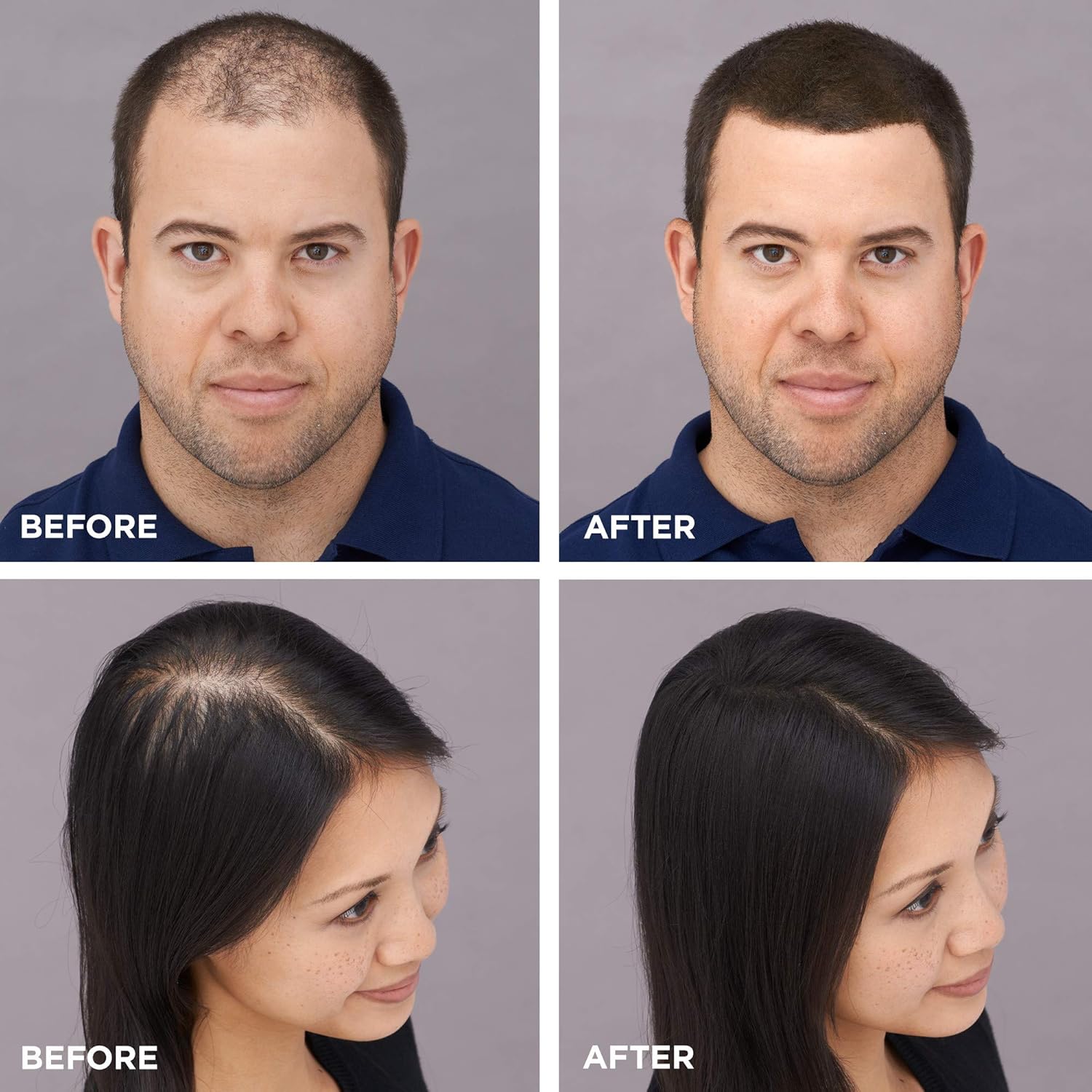 Toppik Hair Building Fibers, 12g Fill In Fine or Thinning Hair Instantly Thicker, Fuller Looking Hair 9 Shades for Men & Women