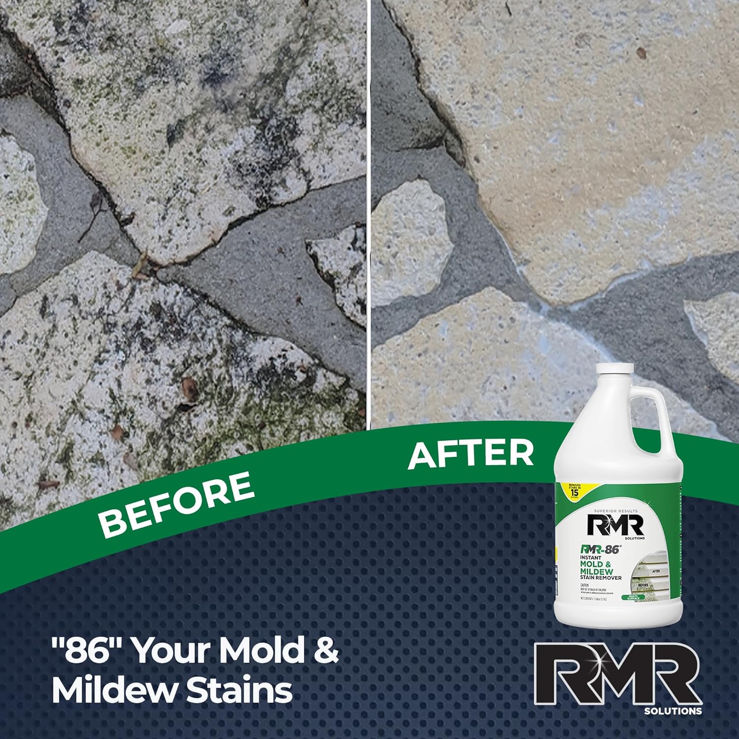 RMR-86 Instant Mold and Mildew Stain Remover Spray - Scrub Free Formula, 32 Fl Oz