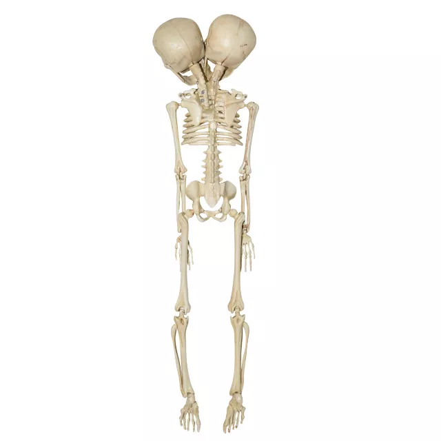 20 Inch Two-Headed Skeleton