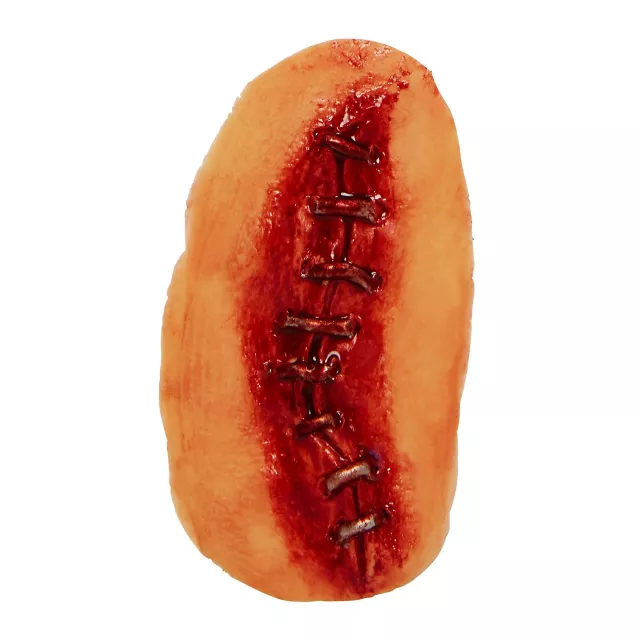 Metal Suture Appliance
