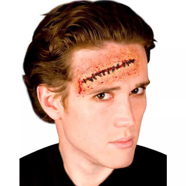 Stitches Appliance