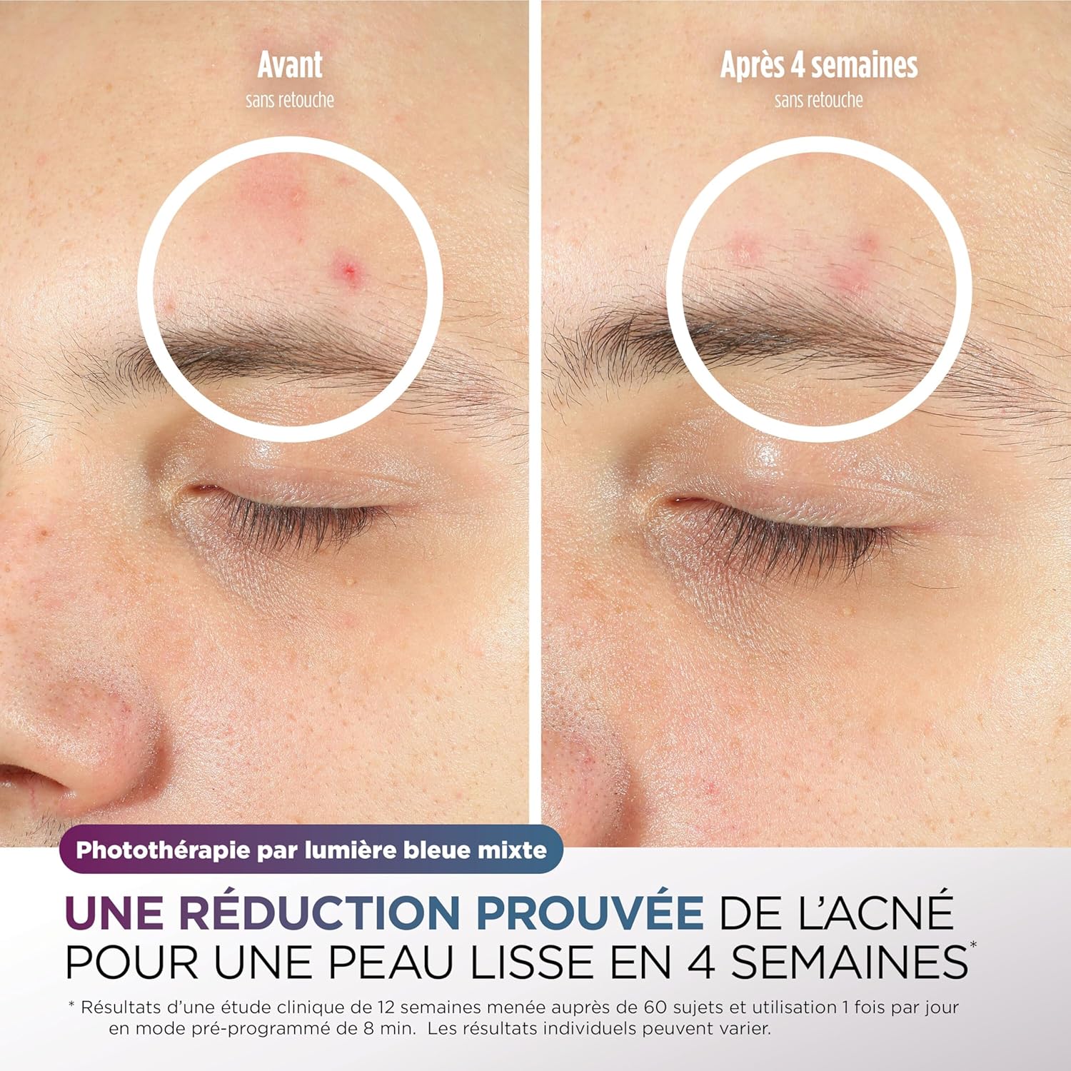 Shark CryoGlow LED Facial Mask - Lilac (Red/Blue/Infrared Light, USB-C, Remote Control)