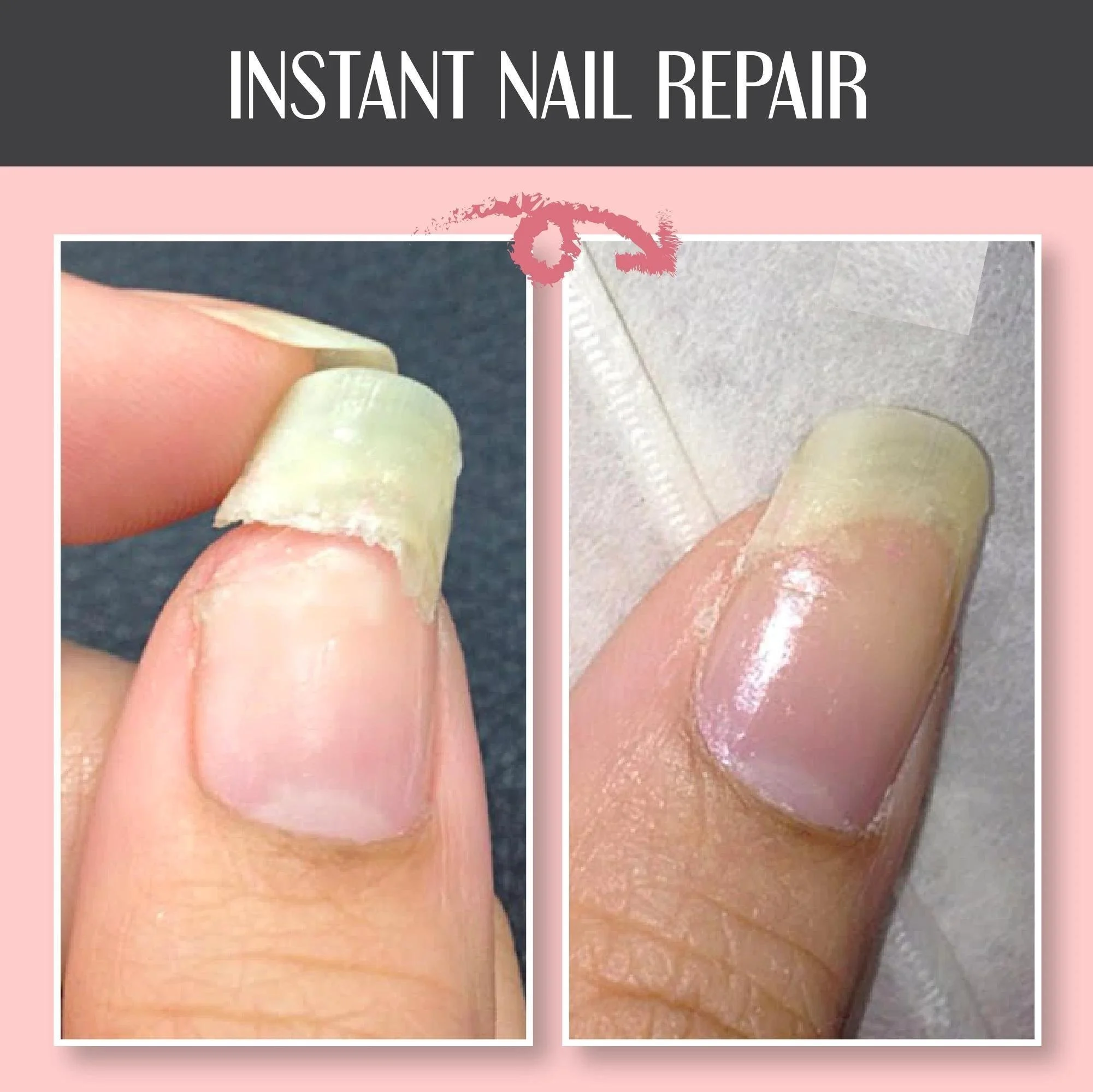 🔥Summer Hot Sale-49% OFF🔥Nail Repair Protection Gel