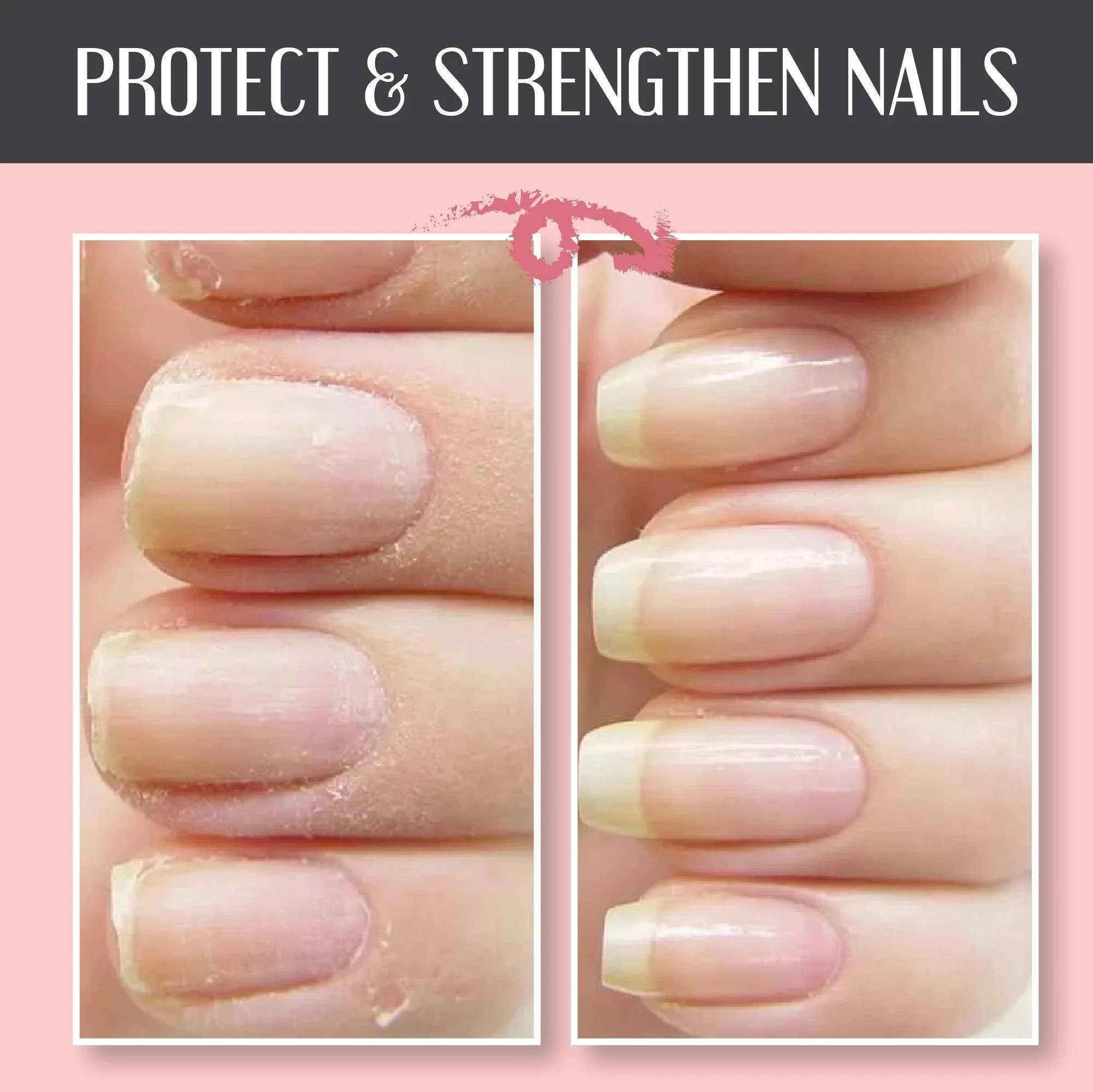 🔥Summer Hot Sale-49% OFF🔥Nail Repair Protection Gel