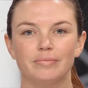 🎉Hot Sales - 49% OFF🔥The Secret Of Age Reduction-- Eyelid Correcting Strips