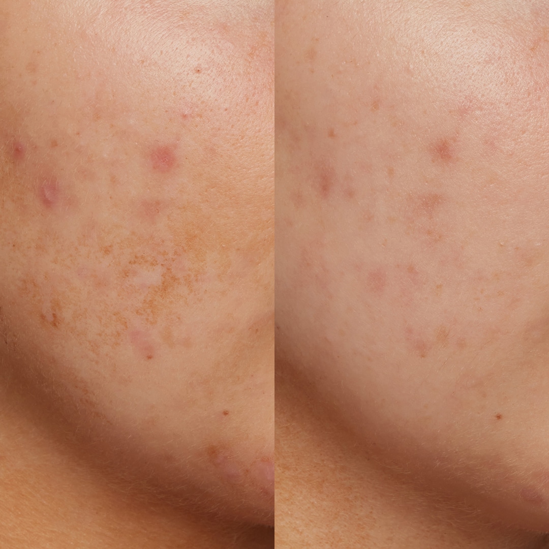 B3 Nice 10% Niacinamide - S&eacute;rum a base de niacinamida y resveratrol