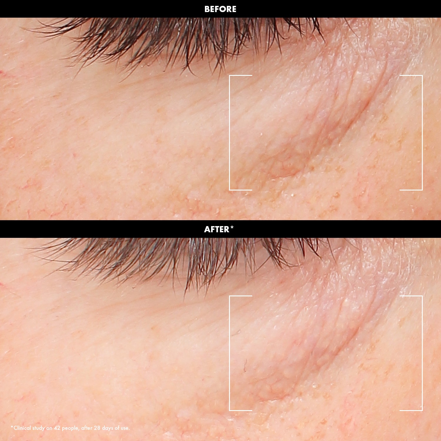 GLOW - Crema de ojos luminosidad con vitamina C y &aacute;cido hialur&oacute;nico