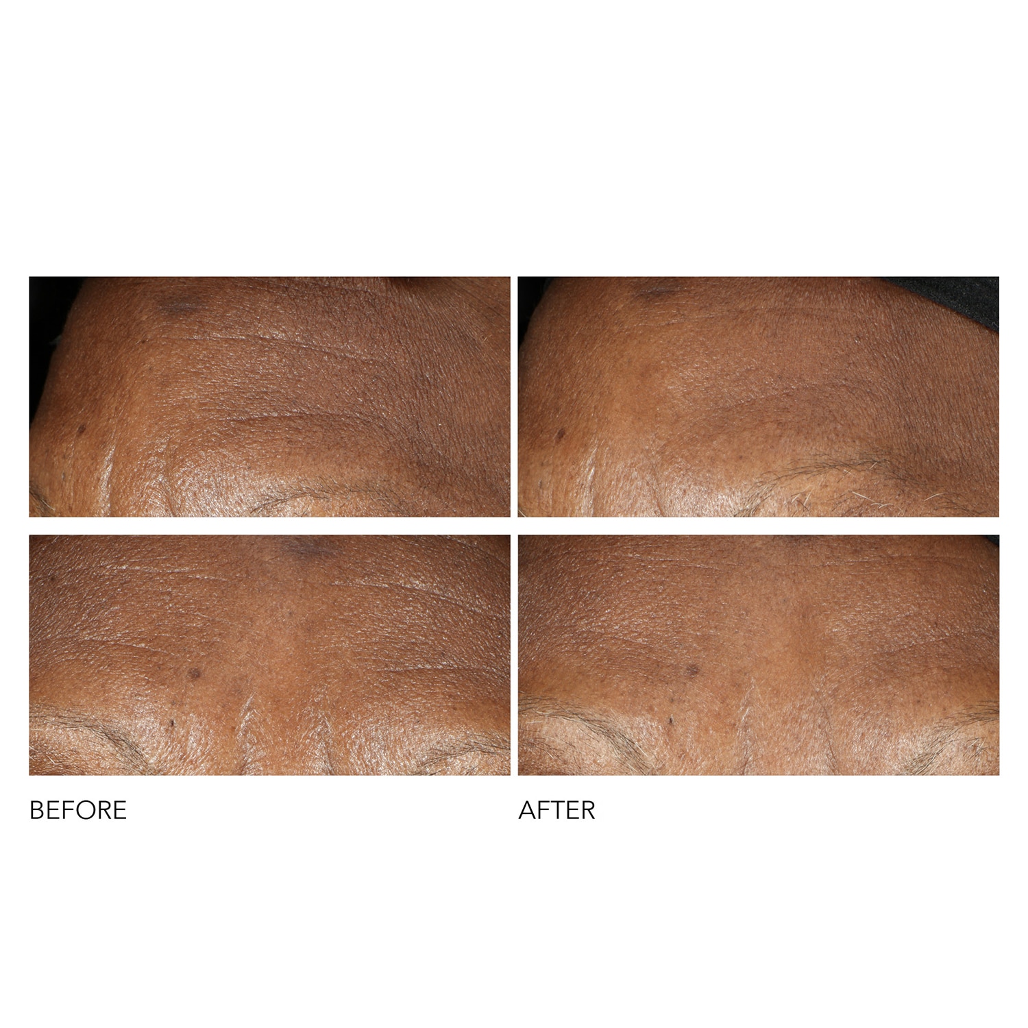 Advanced Retinol + Ferulic - Crema Antiarrugas Intensa