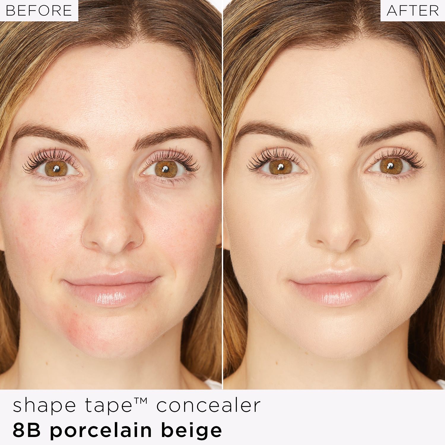 Shape Tape&trade; - Corrector