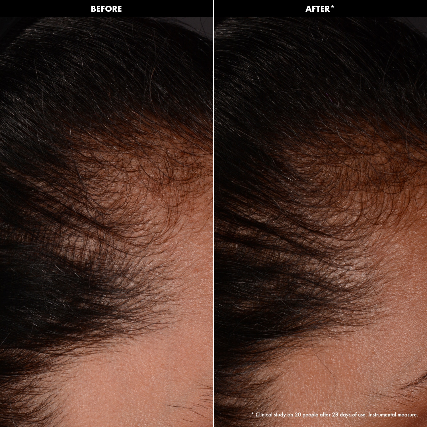 S&eacute;rum Fortificante Y Redensificante - S&eacute;rum Cuero Cabelludo