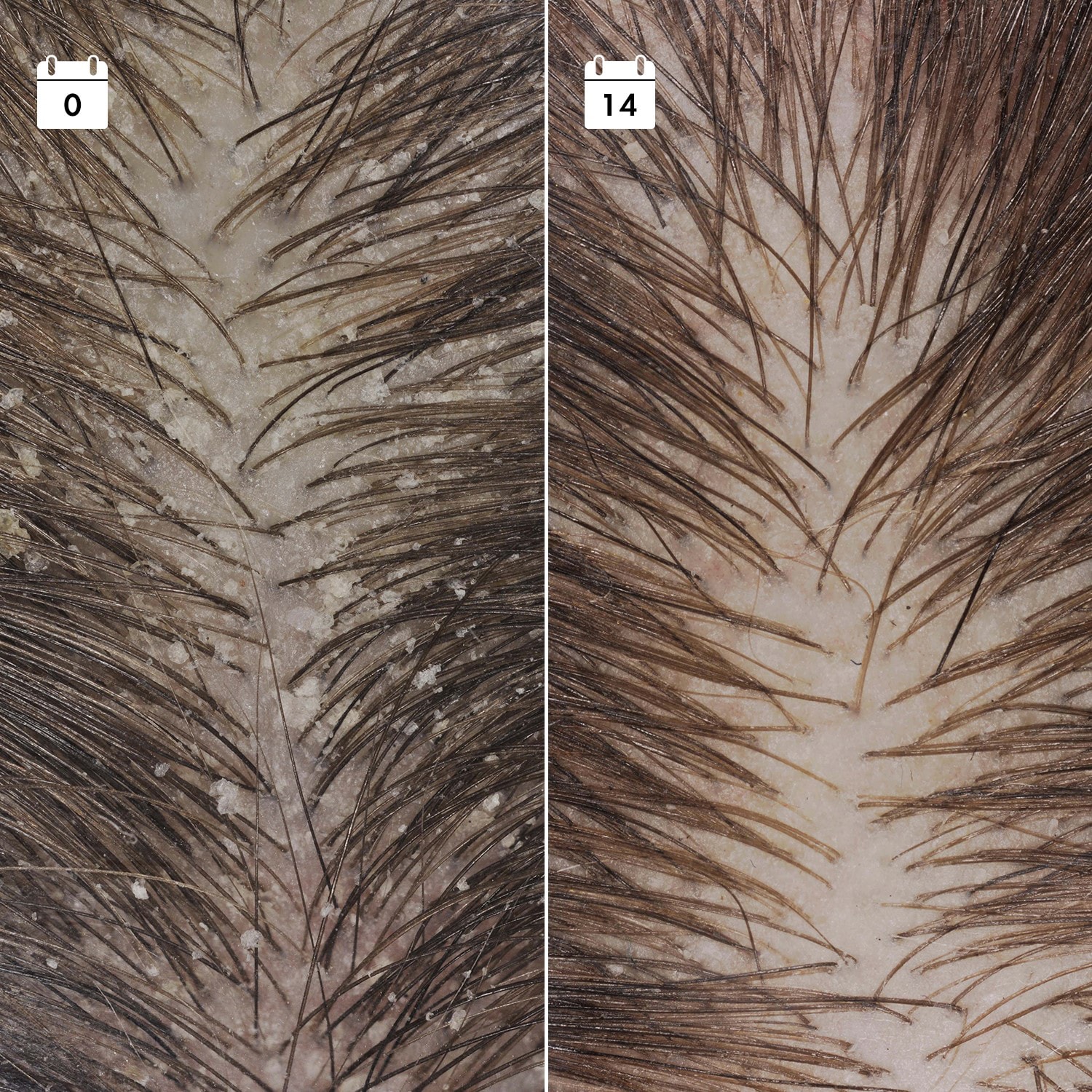 S&eacute;rum Anticaspa Reincidente - S&eacute;rum cuero cabelludo