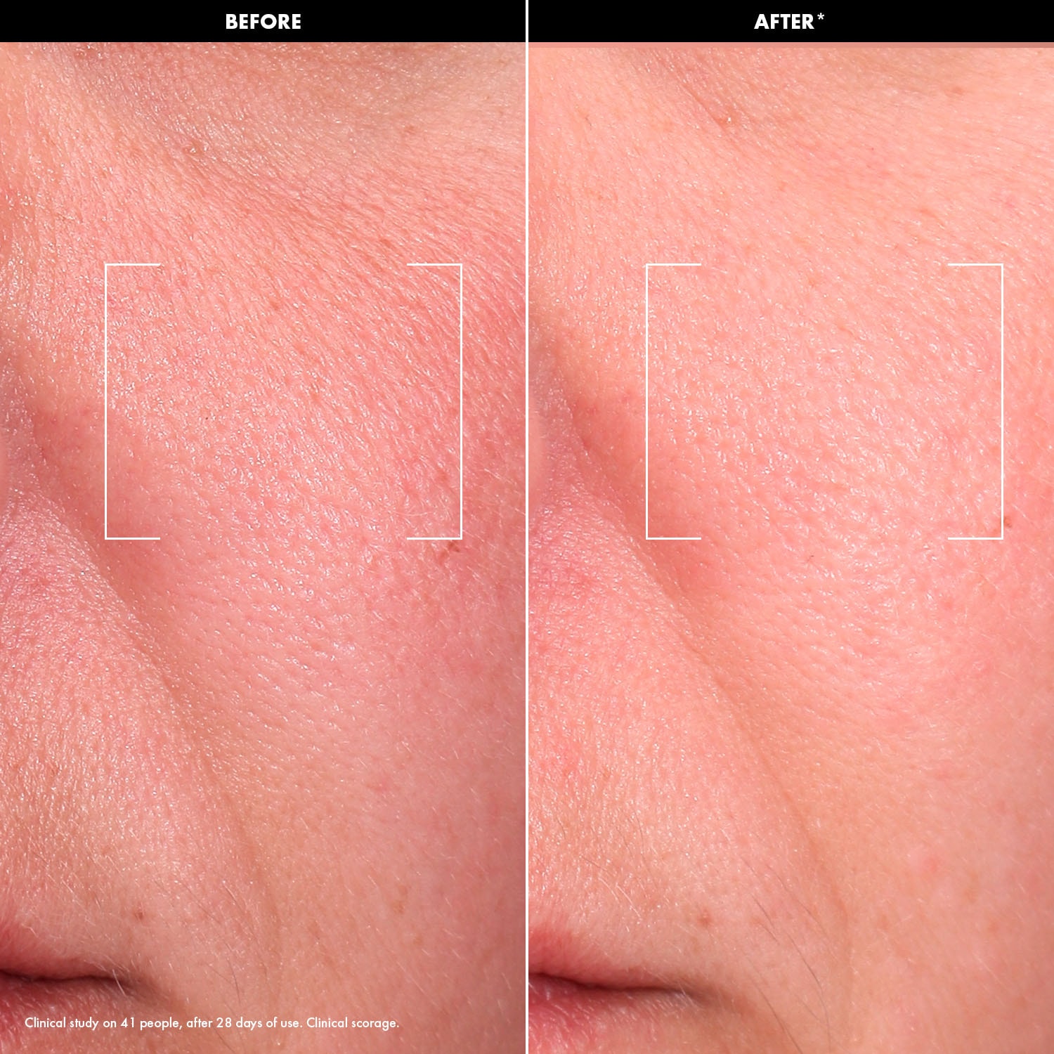 GLOW - Gel-crema iluminador con vitamina C y &aacute;cido poliglut&aacute;mico