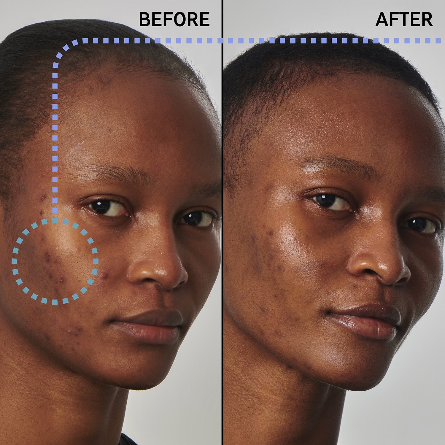 Soluci&oacute;n contra el exceso de sebo con niacinamida al 20% - S&eacute;rum facial