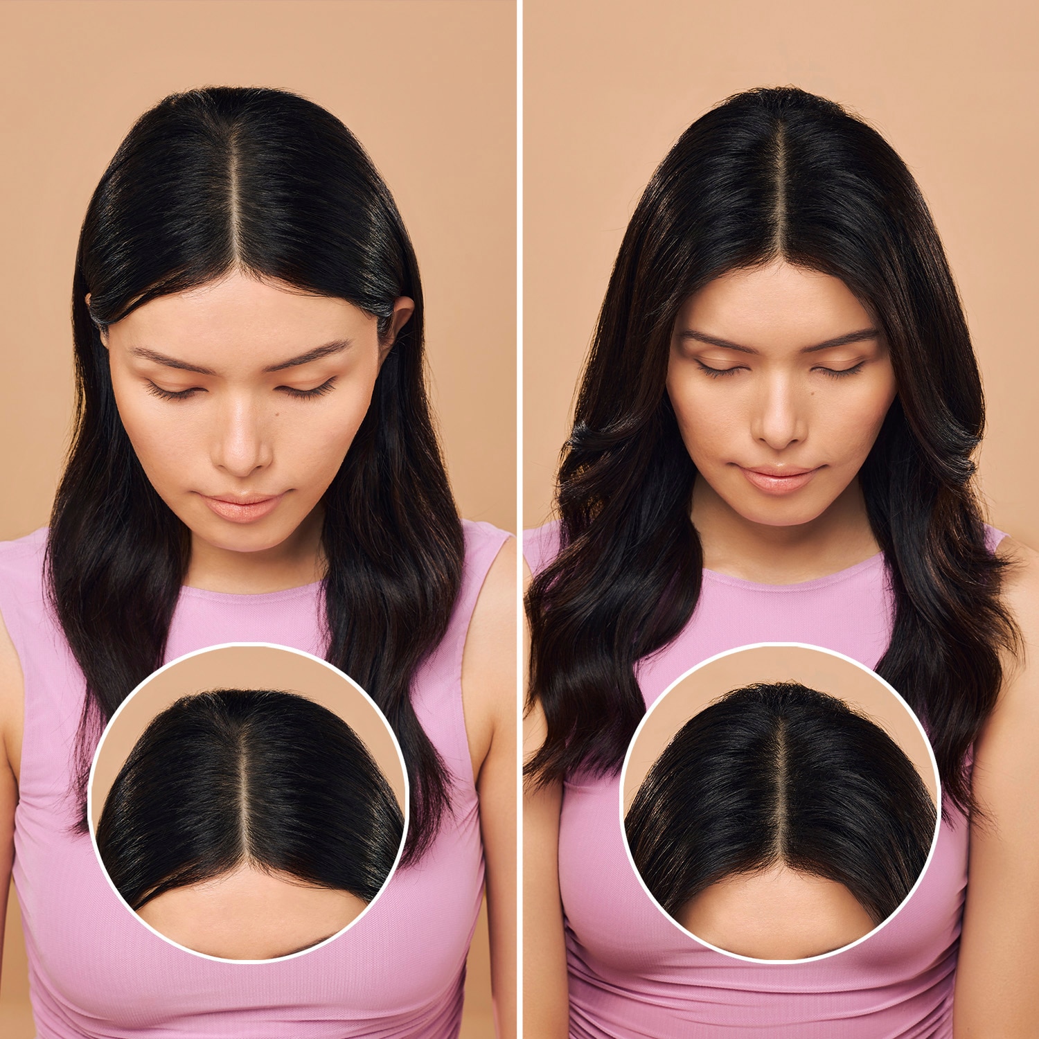 Root Refresh - Champ&uacute; Seco Refrescante