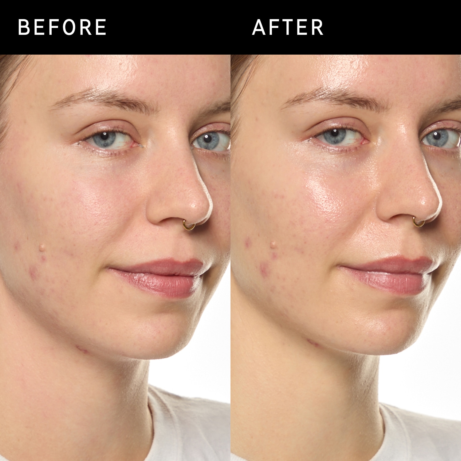 Ectoin Hydro-Barrier Serum - S&eacute;rum Hidratante y Protector