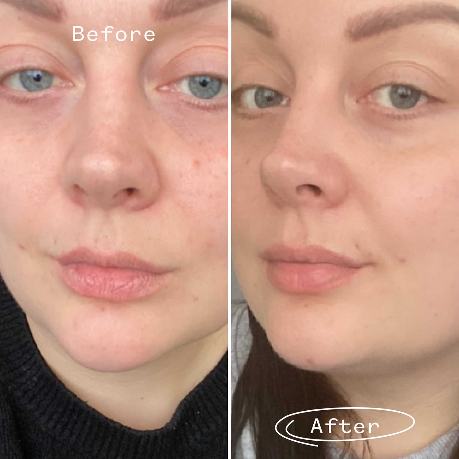 Rosehip Bioregenerate - Aceite universal de rosa mosqueta