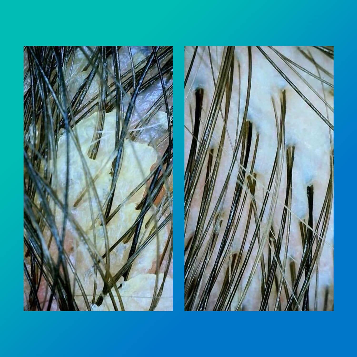 PEPTIDE PREP Detox Shampoo - No Decolorante