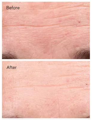 Retinol Youth Renewal Serum 30ml