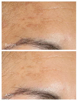 Vita-C Glycolic Brightening Serum