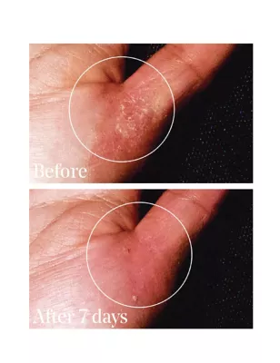 Quick Relief Moisture Treatment 30ml