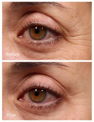 Retinol Youth Renewal Eye Serum 15ml